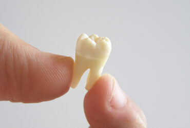 Sonhar Arrancando o Próprio Dente Com a Mão: 9 Significados