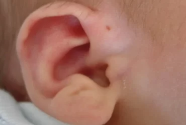 Segundo Furinho na Orelha: Significado Espiritual